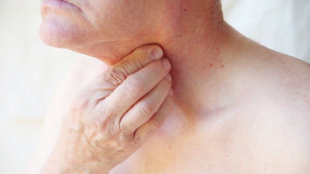 下咽癌 (Hypopharyngeal Carcinoma)